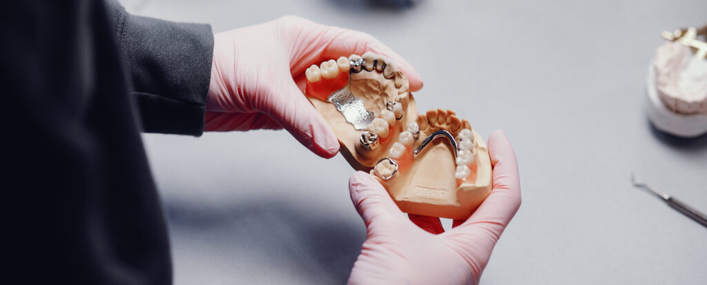 Modell eines Gebisses in Dentaltechnikerhänden.