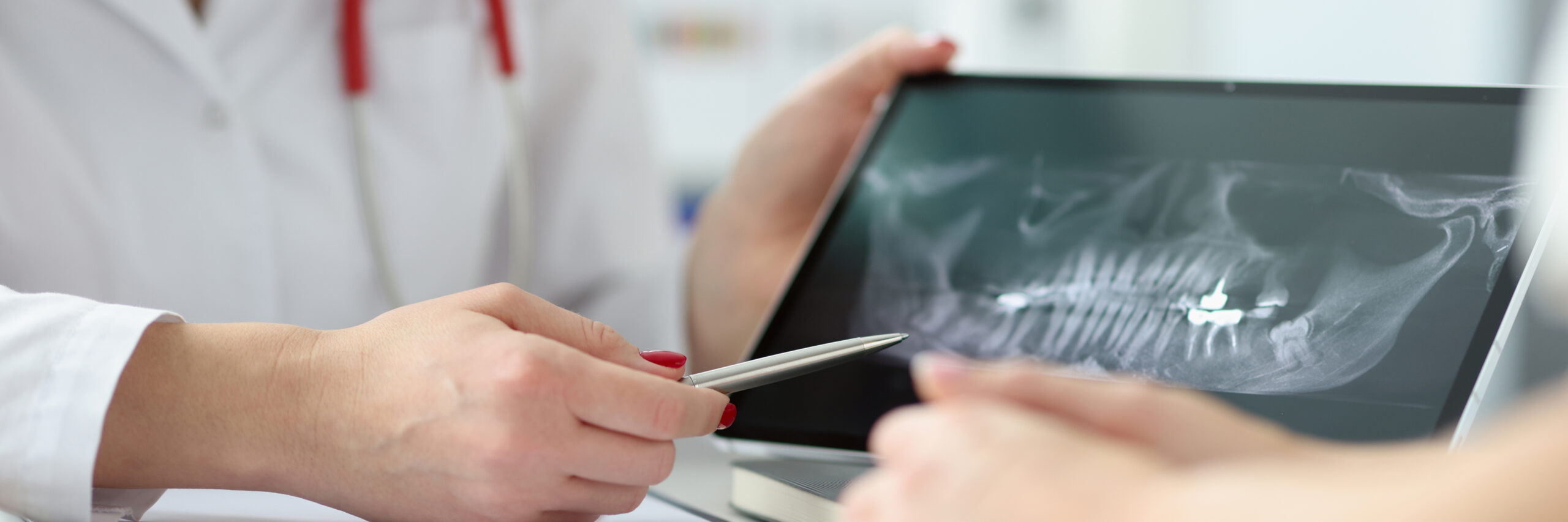 Zahnarzt zeigt Röntgenbild auf Tablet für Zahnbehandlung.