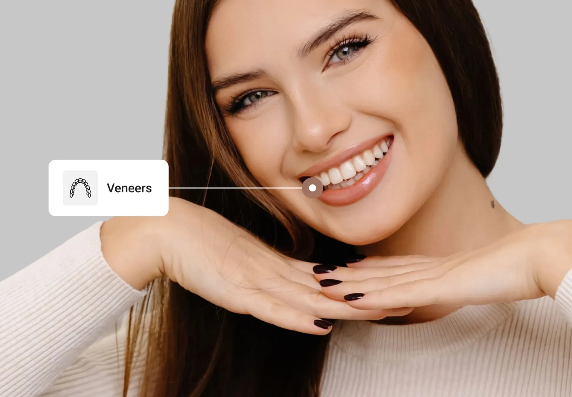 Lächelnde Frau zeigt schöne Zähne mit Veneers in moderner Zahnmedizin.