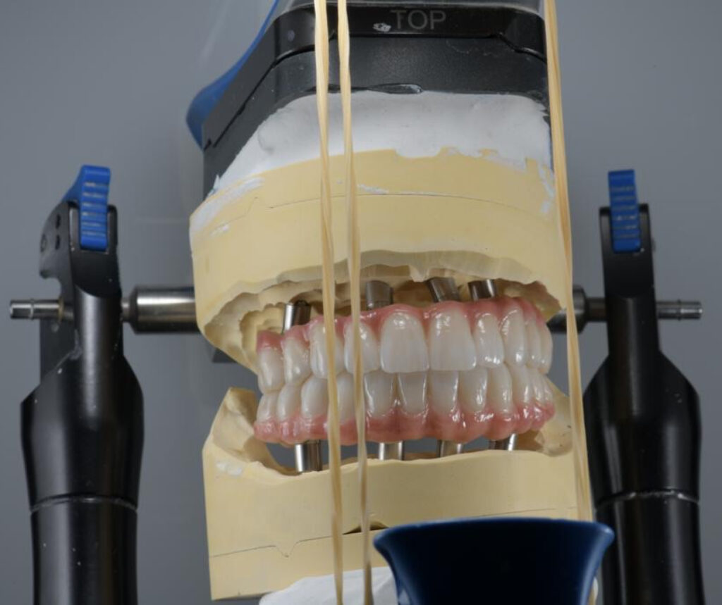 Zahnprothese auf Modell im Dentallabor, Zahnmedizin-Technik.